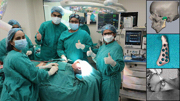 India’s First Indigenous Customized TMJ Implants Successfully Fitted in Four Patients