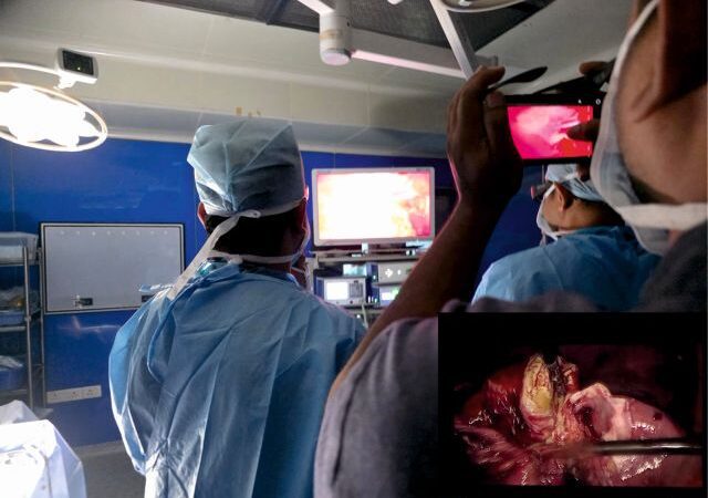 Surgeons at CARE Hospitals, Malakpet Save 72-Year-Old Woman Through High-Risk Laparoscopic Gallbladder Surgery
